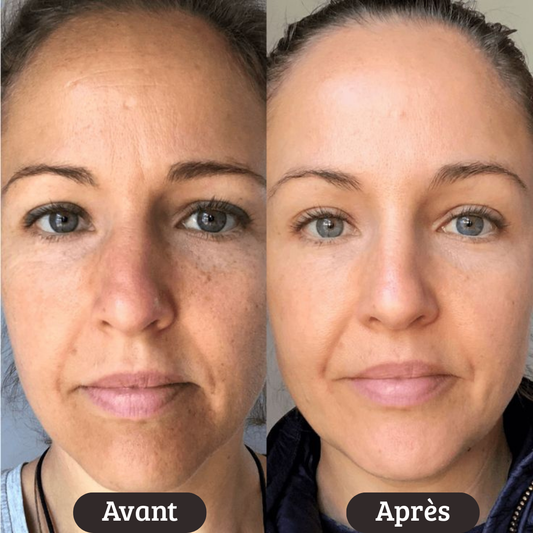 🌟 Crème  Anti-Âge, Anti-Cernes & Anti-Poches